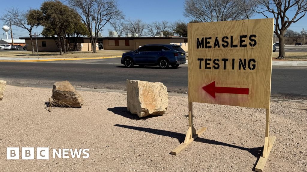 US measles outbreak claims two lives