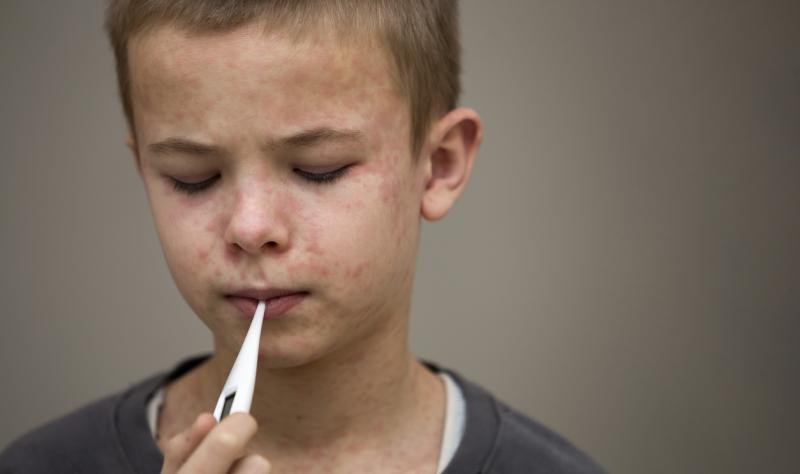 US measles cases reach new post-elimination high